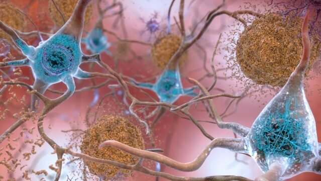 Foto: National Institute on Aging, NIH