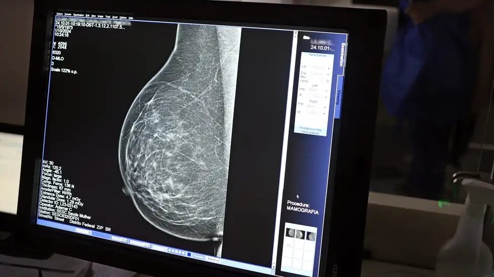Mamografia